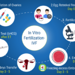 procedure of IVF in Kathmandu