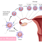 icsi treatment cost in mumbai