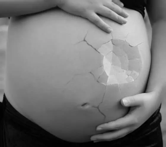 Miscarriage cost Bangalore 2019 – Select IVF India Miscarriage cost Bangalore 2019 - Select IVF India