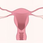 Hysteroscopy Cost In Gurgaon 2020