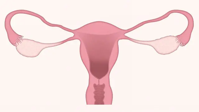 Hysterectomy cost in Mumbai