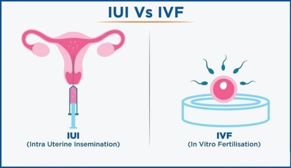 difference between IUI and IVF