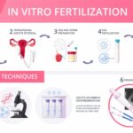 Best IVF Cost in Nepal