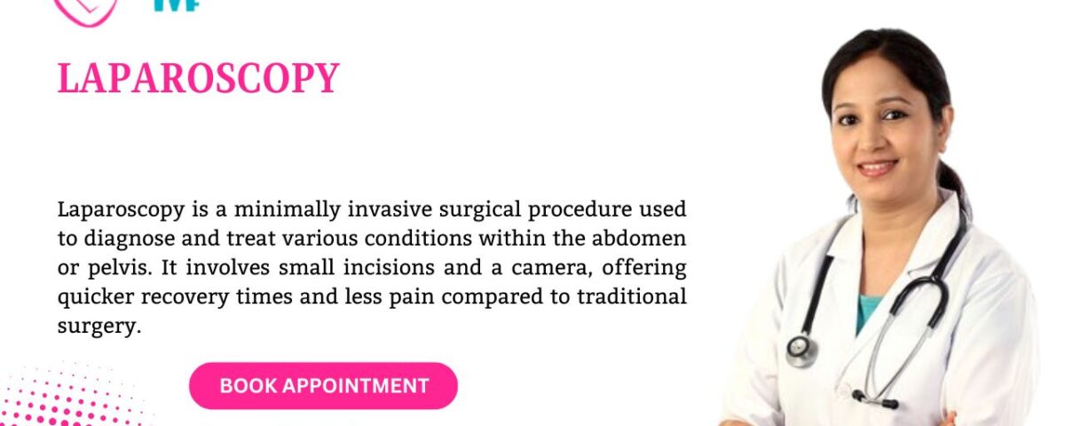 Laparoscopy